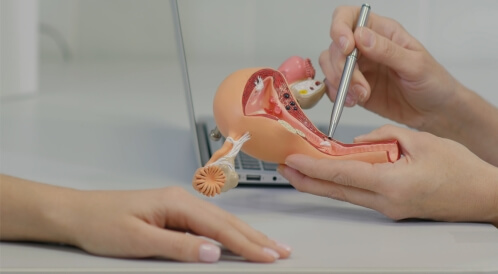 تعرف على أعراض سرطان الرحم المبكرة