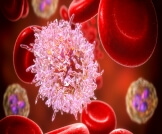أهم المعلومات حول سرطان الدم الليمفاوي المزمن