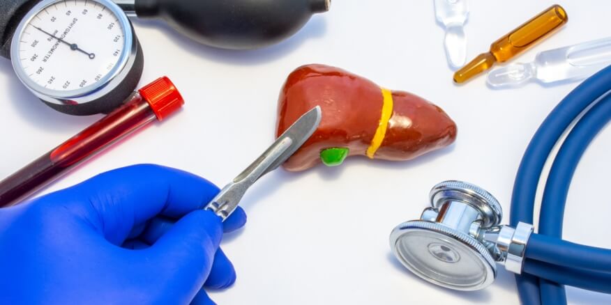 كيس دموي على الكبد: أسباب وعلاجات - ويب طب