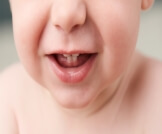 ظهور أسنان الرضيع مبكرًا: معلومات تهمك