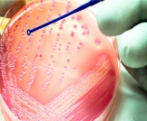 طرق تشخيص البكتيريا: تعرف عليها