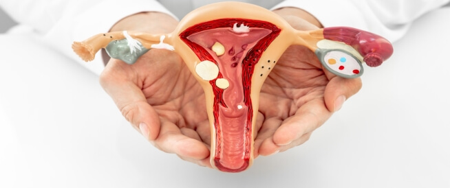 Quali sono le complicanze dell’ulcera cervicale? - Medicina del web