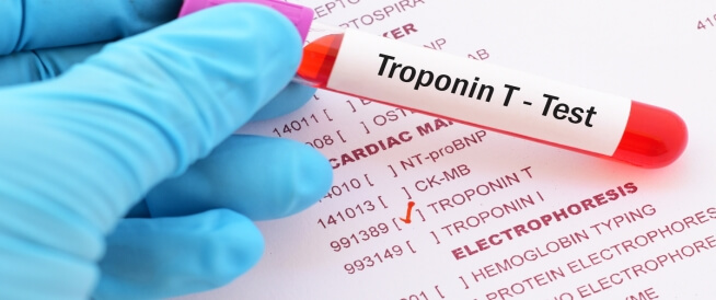 الفرق بين Troponin I وTroponin T