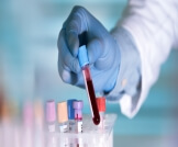 تحليل S. Albumin: دليلك الشامل
