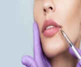 فيلر الكالسيوم: الخصائص والاستخدامات