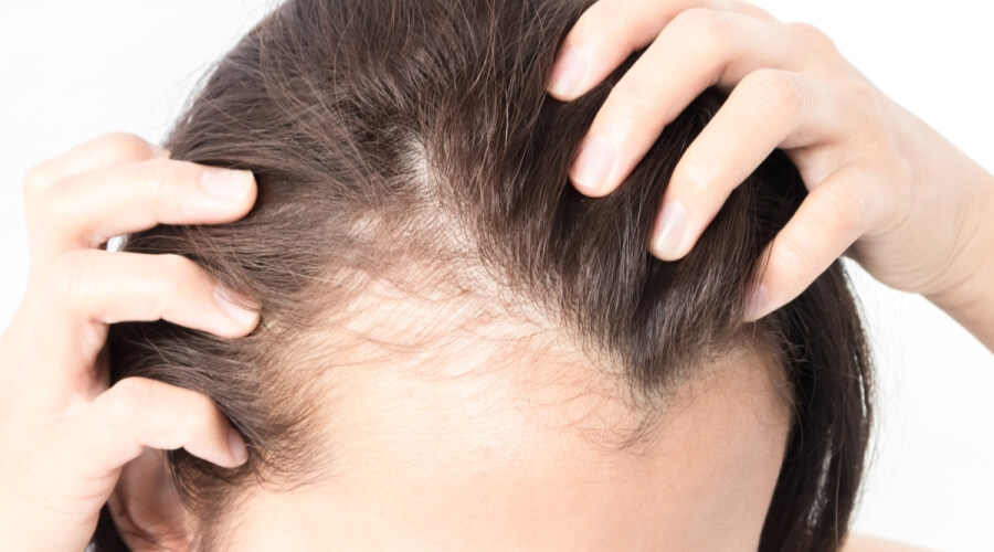 كشف على حد سواء السكتة الدماغية  علاج الشعر الخفيف - ويب طب