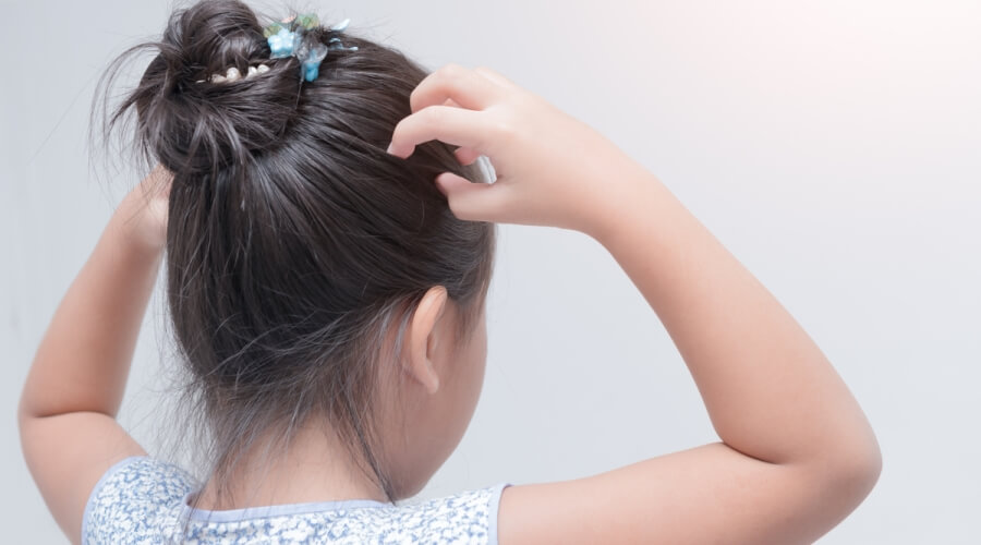 علاج حكة الرأس عند الأطفال ونصائح للتخفيف منها ويب طب