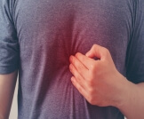 حرقة الفؤاد: حموضة مزعجة في حلقك