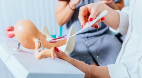 التلقيح داخل الرحم: أبرز المعلومات