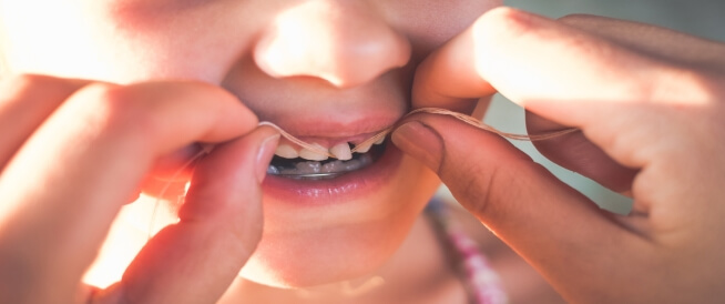 تعليمات بعد خلع الاسنان للاطفال