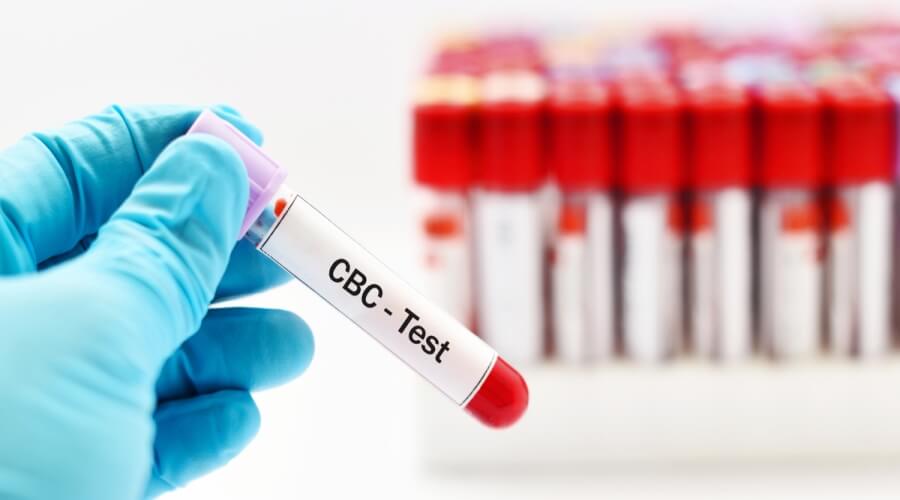 هل تحليل cbc يكشف السرطان؟ - ويب طب