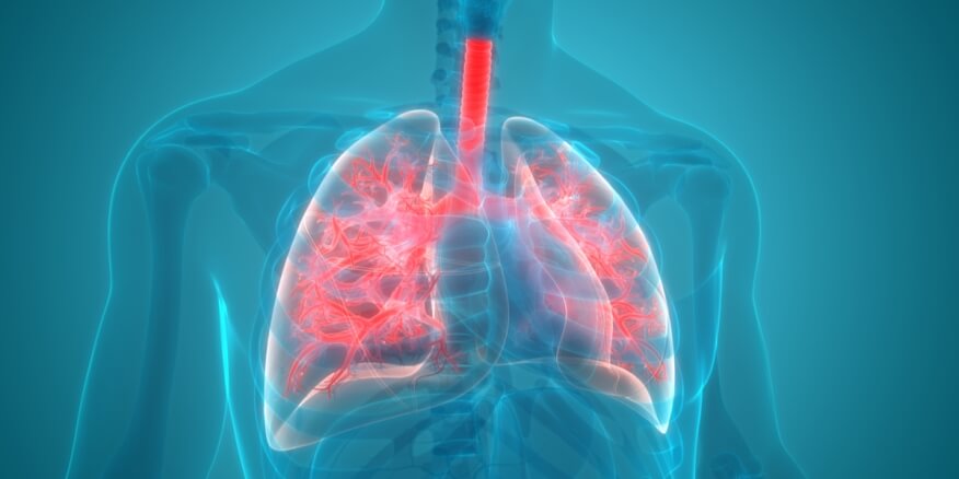 علامات الالتهاب الرئوي - ويب طب
