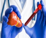 هل ارتفاع إنزيمات الكبد خطير؟