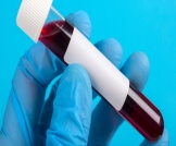 تحليل حساسية الدم