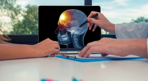 أخطر أنواع سرطان الدماغ: تعرف عليها