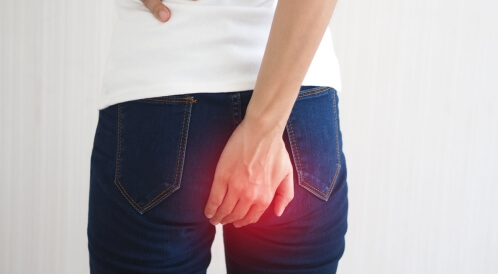 البواسير الخارجية: أبرز المعلومات 