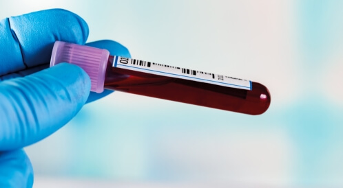 تحليل inr: دليلك الشامل إليه