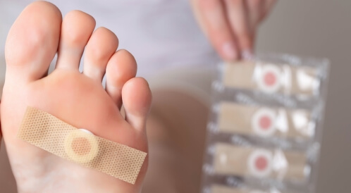 حمض الساليسيليك للثآليل: هل هو فعال؟