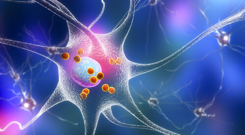 خرف أجسام ليوي