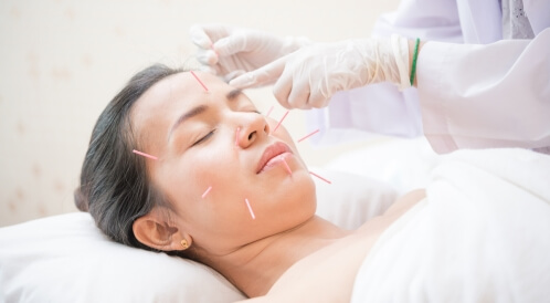 فوائد الإبر الصينية للوجه: 6 فوائد ستذهلك