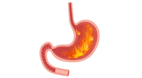 التخلص من الحموضة فورًا: إليك الحلول