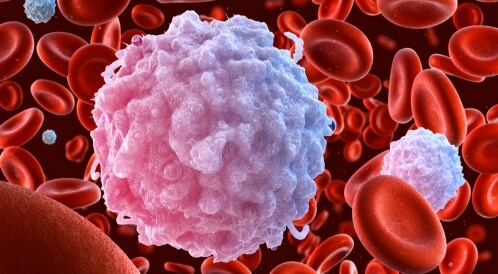 التهاب كريات الدم البيضاء