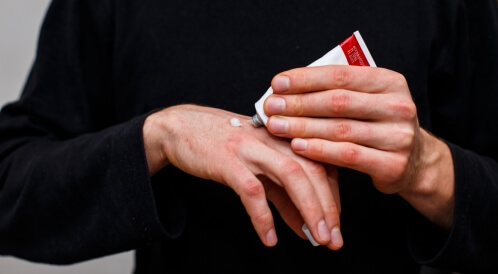 أفضل كريم لعلاج الصدفية: ما هو؟