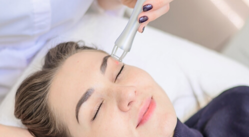 التقشير البارد: دليلك الشامل