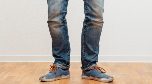 تقوس القدمين: دليلك الشامل إليه