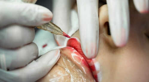 أضرار توريد الشفايف: تعرف عليها