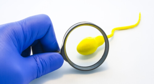 وهن النطاف: حالة قد تقلل خصوبة الرجل