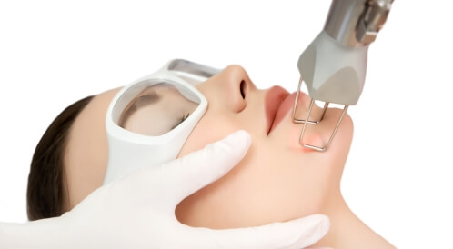 فراكشنال ليزر: دليلك الشامل