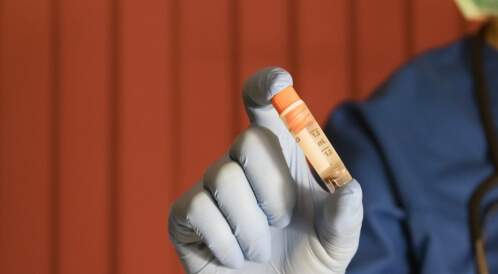 زراعة الخلايا الجذعية: معلومات هامة