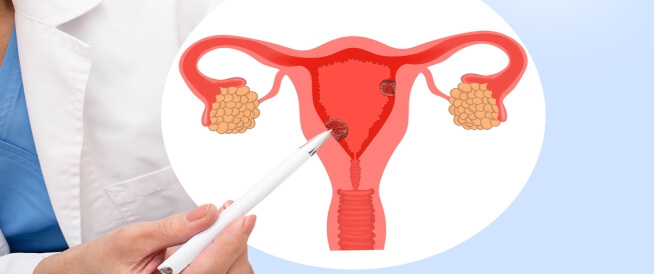 Damage to the thick endometrium