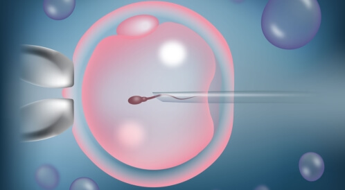 نسبة نجاح الحقن المجهري: تعرف عليها