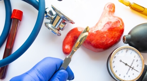 بطء نزول الوزن بعد التكميم: أسباب ونصائح لك