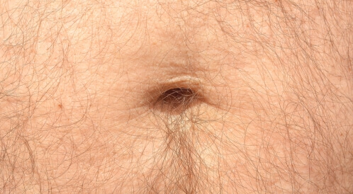 ظهور شعر حول السرة: الأسباب والعلاج