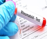 ما هو تحليل Rheumatoid factor؟