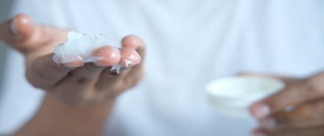 علاج الصدفية بالفازلين: هل هو ممكن؟