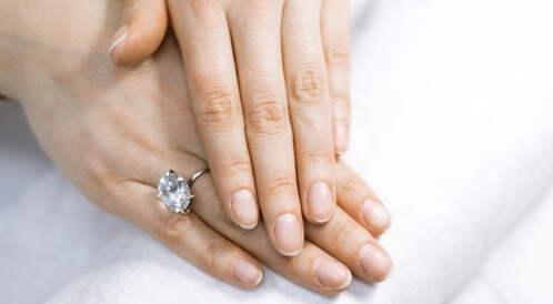 تغير شكل الأظافر: أسباب ونصائح لك