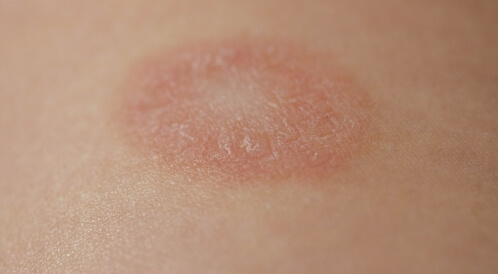 النخالة الوردية والاستحمام: كل التفاصيل التي تهمك