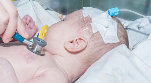 ظهور عروق في رأس الرضيع: معلومات تهمك