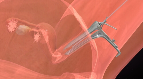 ترجيع الأجنة المجمدة: دليلك الشامل