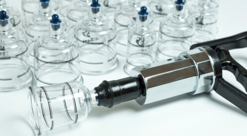 علاج ضغط العين بالحجامة: هل هو ممكن؟