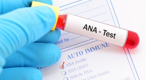ما هو تحليل ana؟: إليك الإجابة