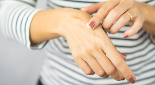 كيف يلتئم جرح السكر؟