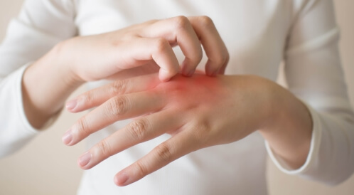 كيفية التخلص من حكة الجسم