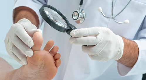 إصبع السكري: دليلك الشامل