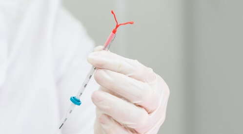 متى يجب تغيير اللولب؟: إليك الإجابة