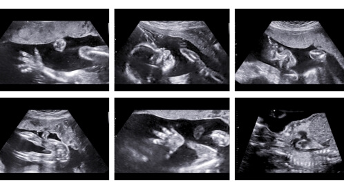 وضعيات الجنين في كل شهر: ماهي؟